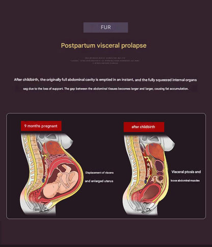 Postpartum belly wrap image 7