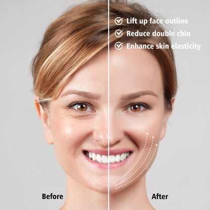 V Facial Lifting Device Image 8